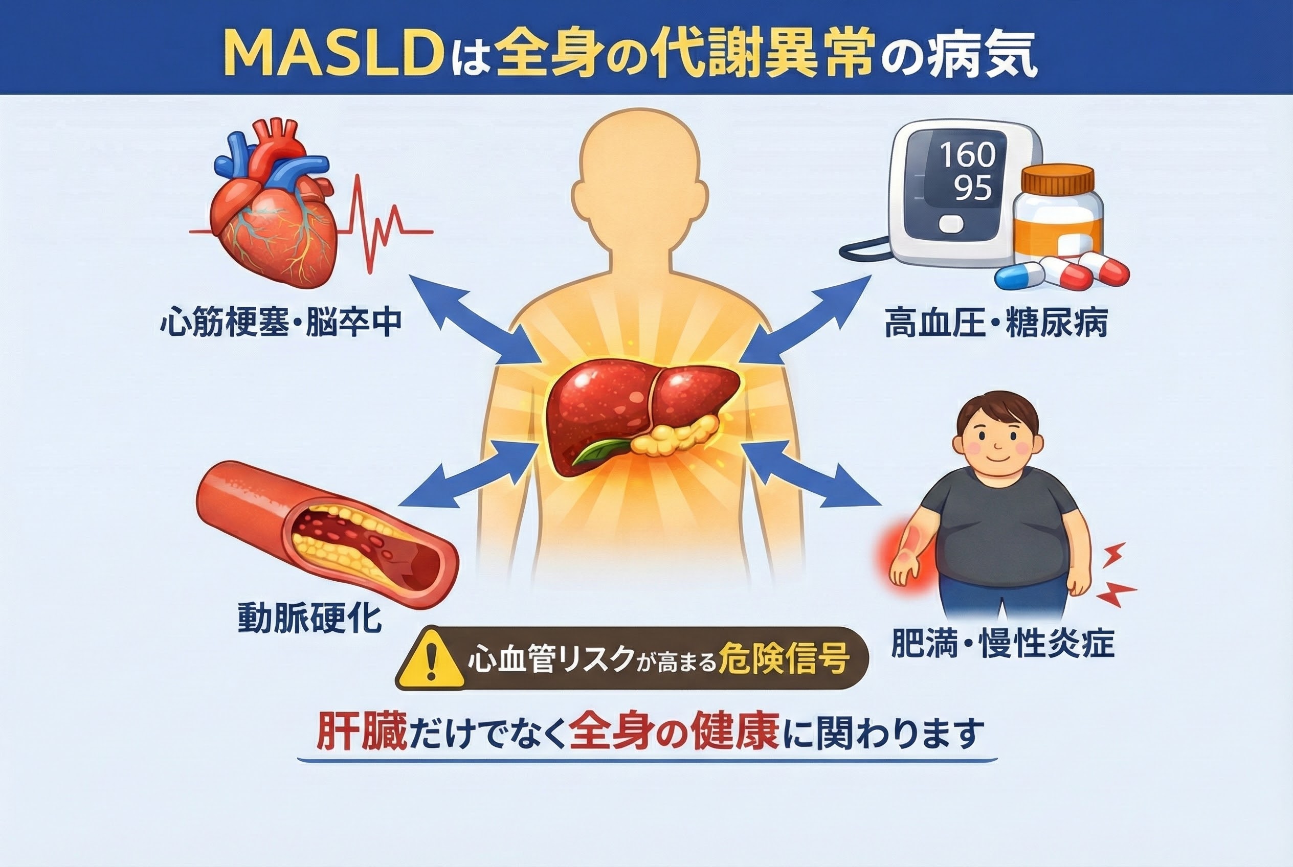MASLDは全身の代謝異常。脂肪肝から心筋梗塞や脳卒中、糖尿病のリスクが高まる仕組み